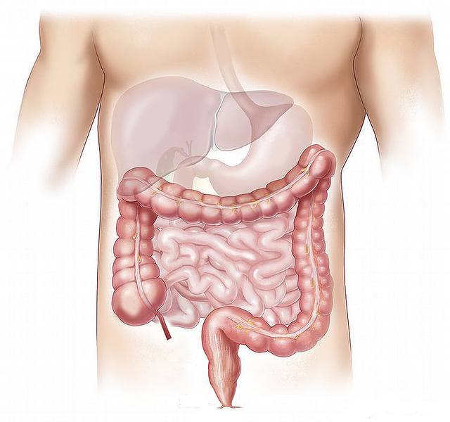 Treat IBS naturally with Diet and Lifestyle modifications - The large intestine is generally get affected