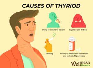 CAUSES OF THYRIOD